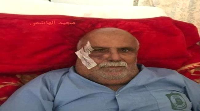 
                     شاهد..أول ظهور للواء احمد مساعد بعد اصابته بحادث مروري في مسقط (صورة)