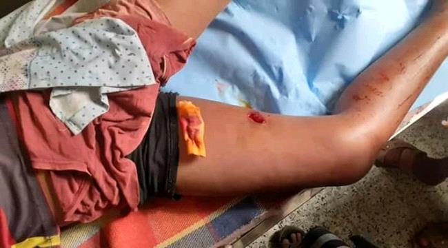 
                     إصابة طفل بجروح خطيرة جراء تعرضه لطلقة قناص حوثي في عيريم لحج