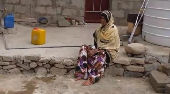 
                     شاهد مأساة يمنية فقدت أسرتها وساقها وذراعها بمقذوف حوثي